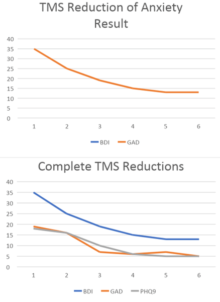 TMS Therapy Treatment - Before & After
